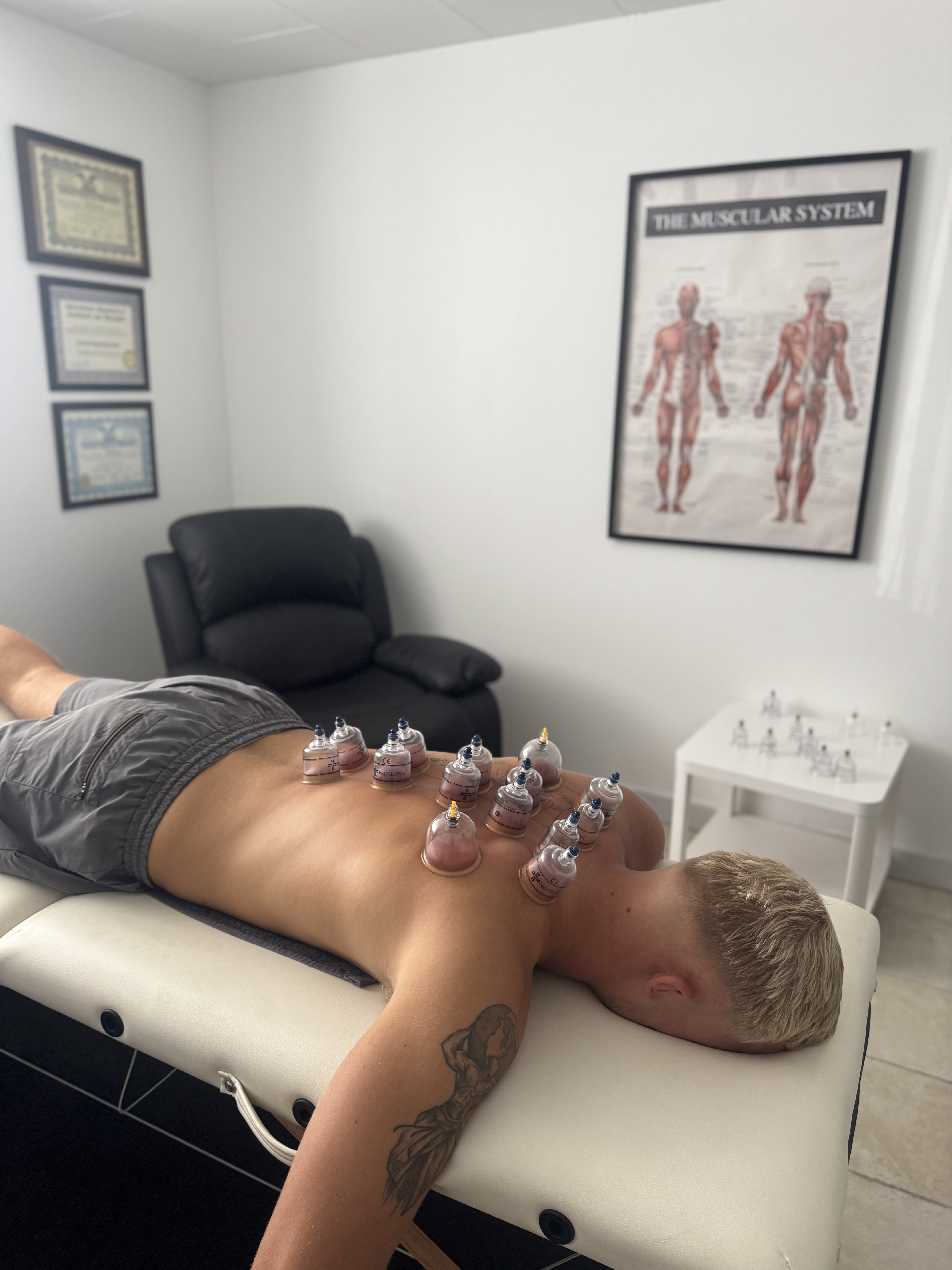 Cupping Behandling